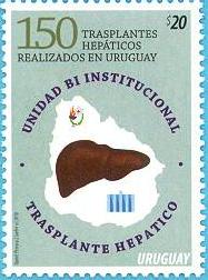150 trasplantes hepáticos realizados en Uruguay - 2018-